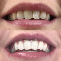 Extra-Strength Whitening 2.0