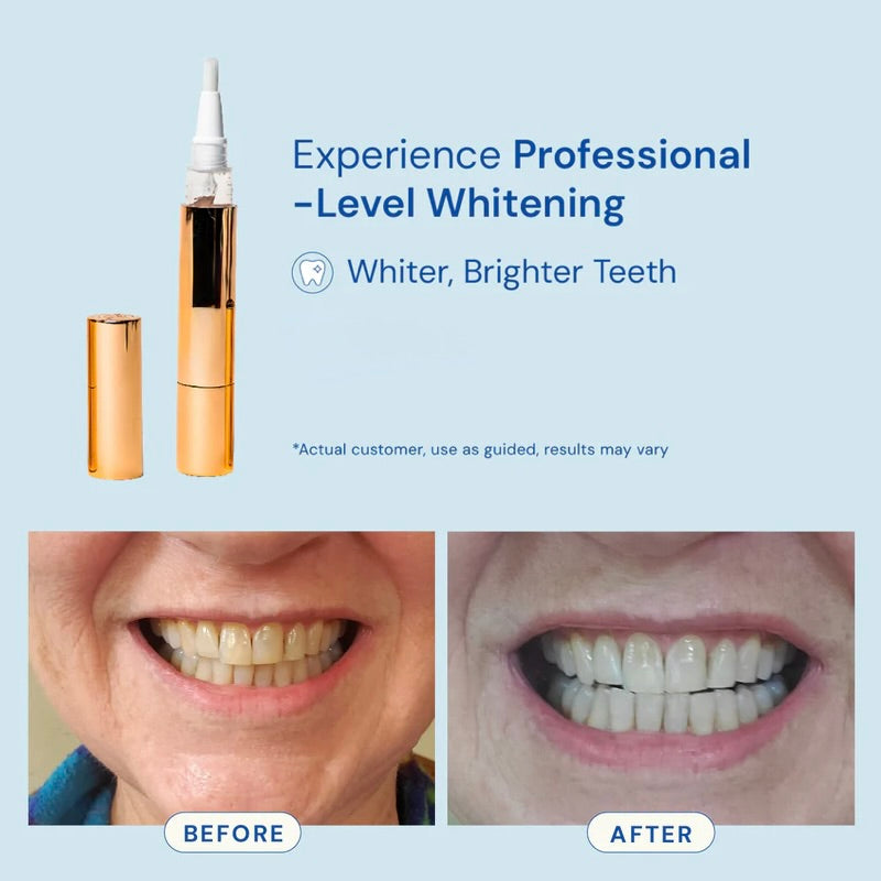 Extra-Strength Whitening 2.0